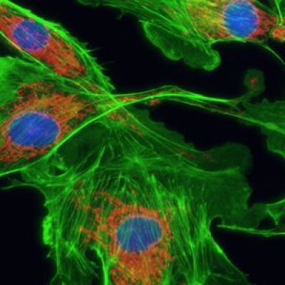 怎么提高顯微鏡的熒光成像的質(zhì)量？